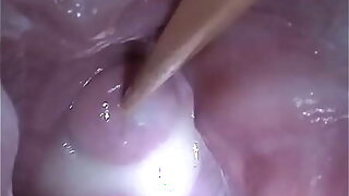 Insertion Semen Cum in Cervix Wide Flourishing Pussy Speculum